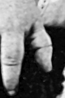 Addie's right thumb